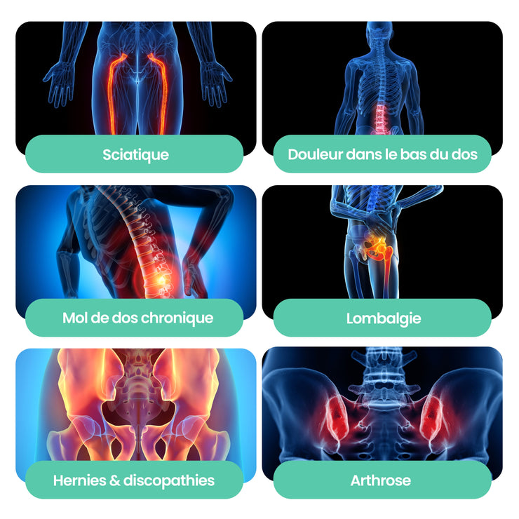 Ceinture de décompression Lomb'Air™｜Sanéo